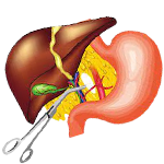 Hepatobiliary